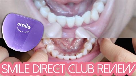 smile direct club scam.